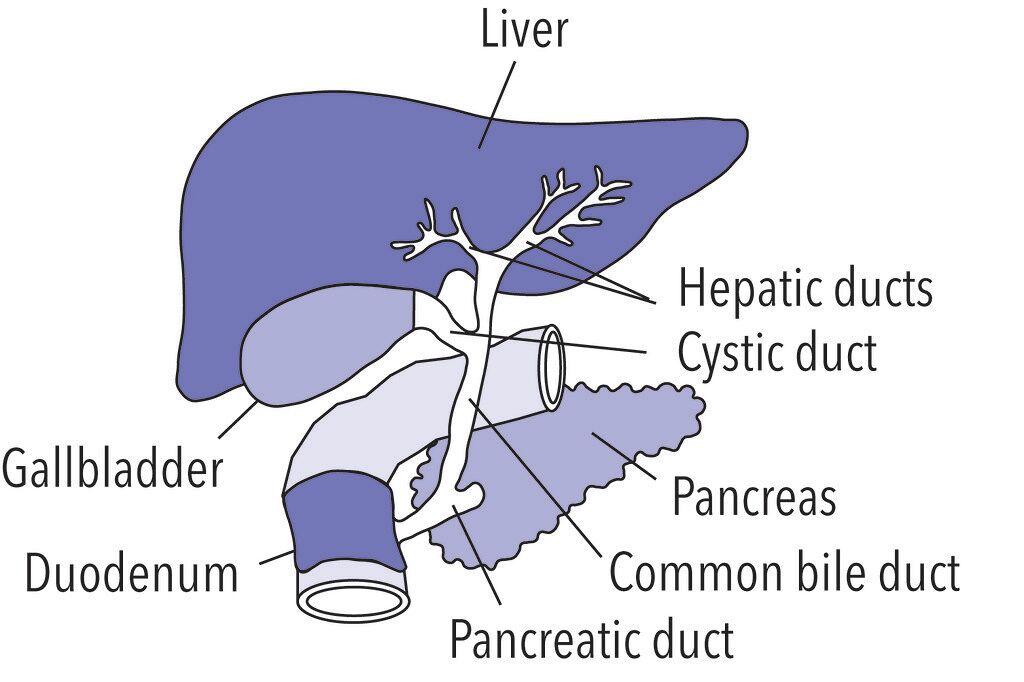 treatment for gallstones