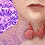 thyroid- graves', hypothyroid, and thyroid health solutions